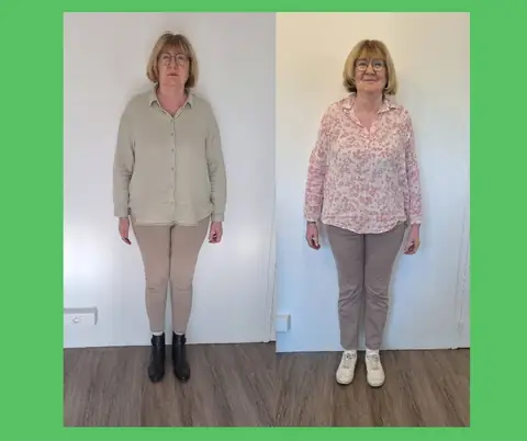 Cliché frontal d’une membre, avant puis après son passage au club