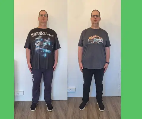 Une membre du club Dax Espace Nutrition de face, avant puis après